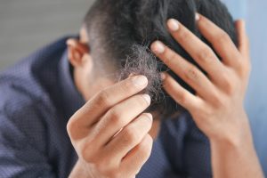 a man showing his fallen hair